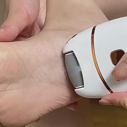 Electric Foot Callus Remover – Rechargeable Pedicure Device with Multiple Heads